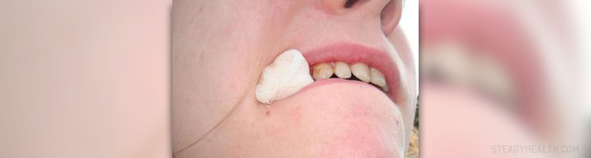 Wisdom Teeth Extraction Jaw Pain