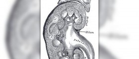 Kidney failure stages