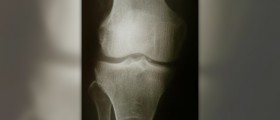 Knee pain relief