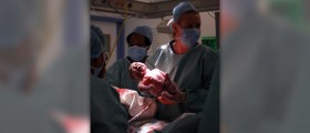 Labour complications