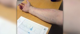 Lanolin allergy facts