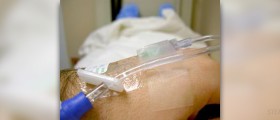 Laparoscopic surgery causes less hassles than others