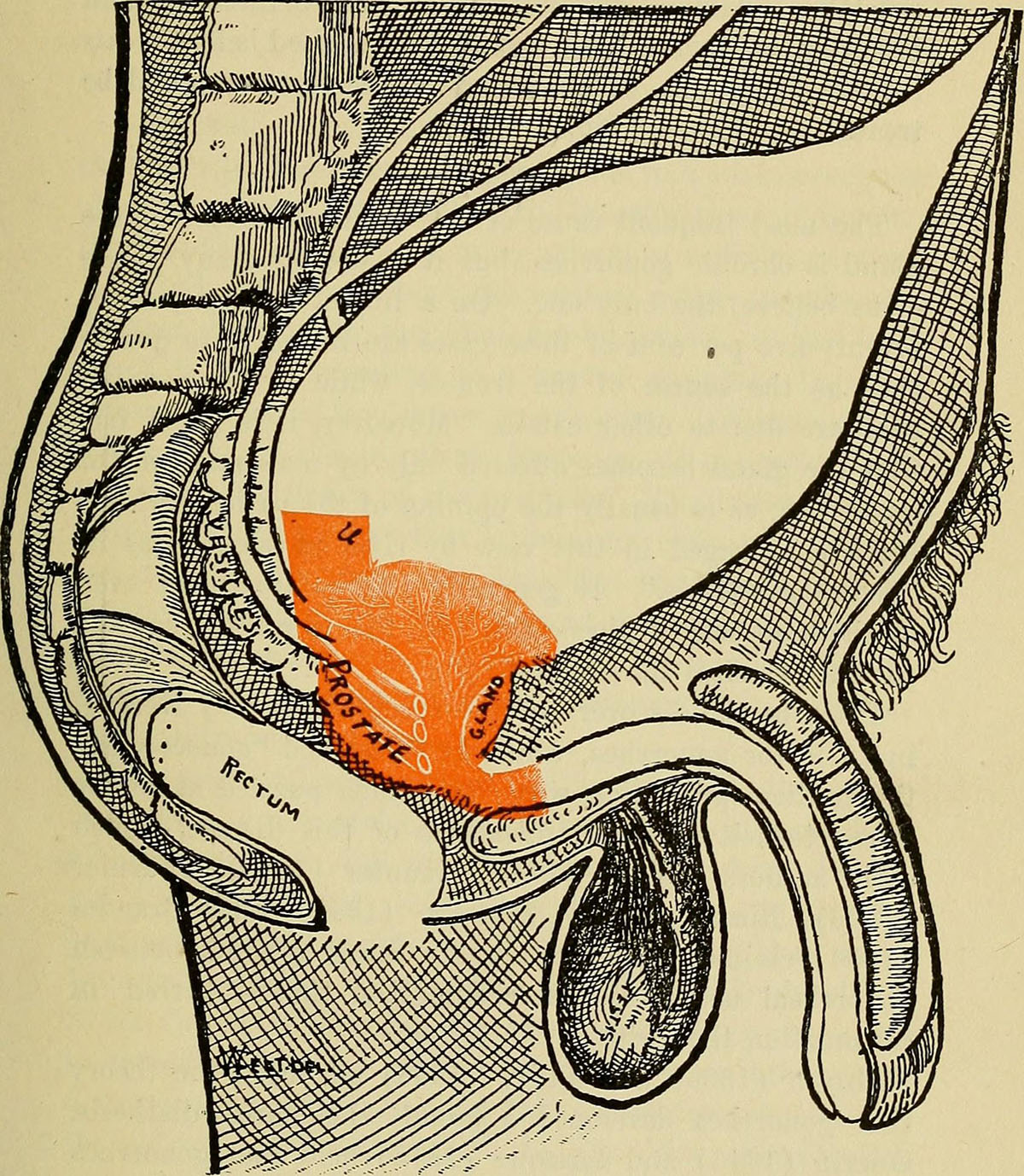 prostate prostatitis problems surgery laparoscopic young steadyhealth general last ic