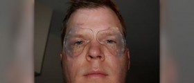 LASIK facts that you need to know