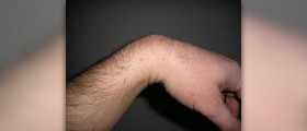Left wrist pain