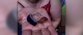 Low cost hearing aids can work effectively