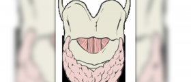Low iodine diet for thyroid cancer