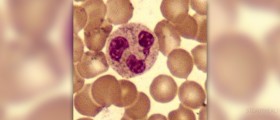 Low neutrophil count