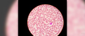 Low white blood cell count