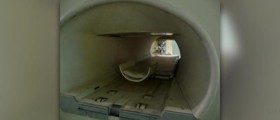 Magnetic resonance angiography