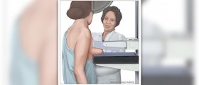 Mammography - Some common uses of the procedure