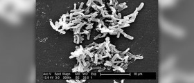 Management and prognosis of Clostridium difficile