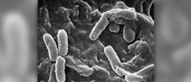 Management of Pseudomonas aeruginosa infections