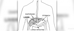 Metastatic liver cancer prognosis