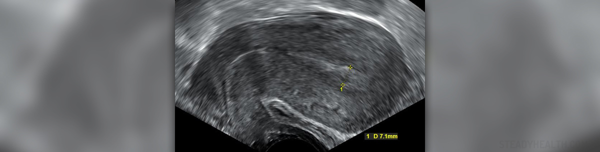 miscarriages-in-first-trimester-general-center-steadyhealth