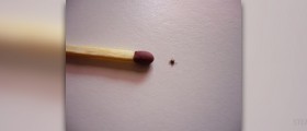 Misdiagnosed lyme disease