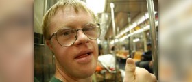 Mosaic down syndrome