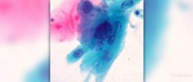 Mouth herpes treatment