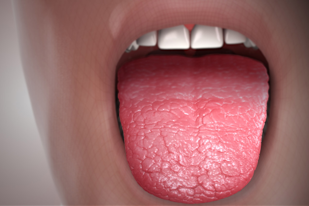 Dry mouth and tongue | General center | SteadyHealth.com