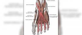 Muscle inflammation - What to do if you have it