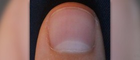 Nail care tips