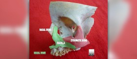 Nasal allergy medications