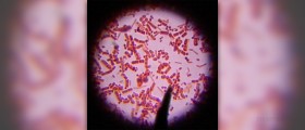 Natural cure for bacterial infection