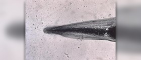 Natural cure for pinworms