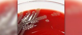 Necrotizing fasciitis (Flesh eating bacteria)