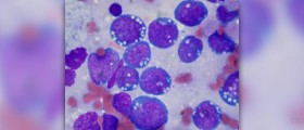 New lymphoma treatment