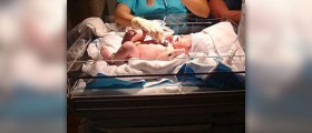 Newborn bowel movements