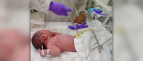 Cord wrapped around baby's neck at ultrasound?