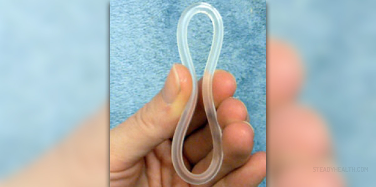 the-vaginal-contraceptive-ring-nuvaring