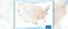 Obesity and cardiovascular disease