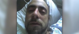 Opioids side effects