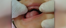 Oral health care in pediatric dentistry Colorado Springs
