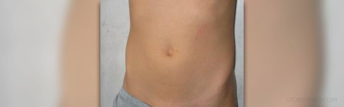 Pain Behind Belly Button Gastrointestinal Disorders Articles Body