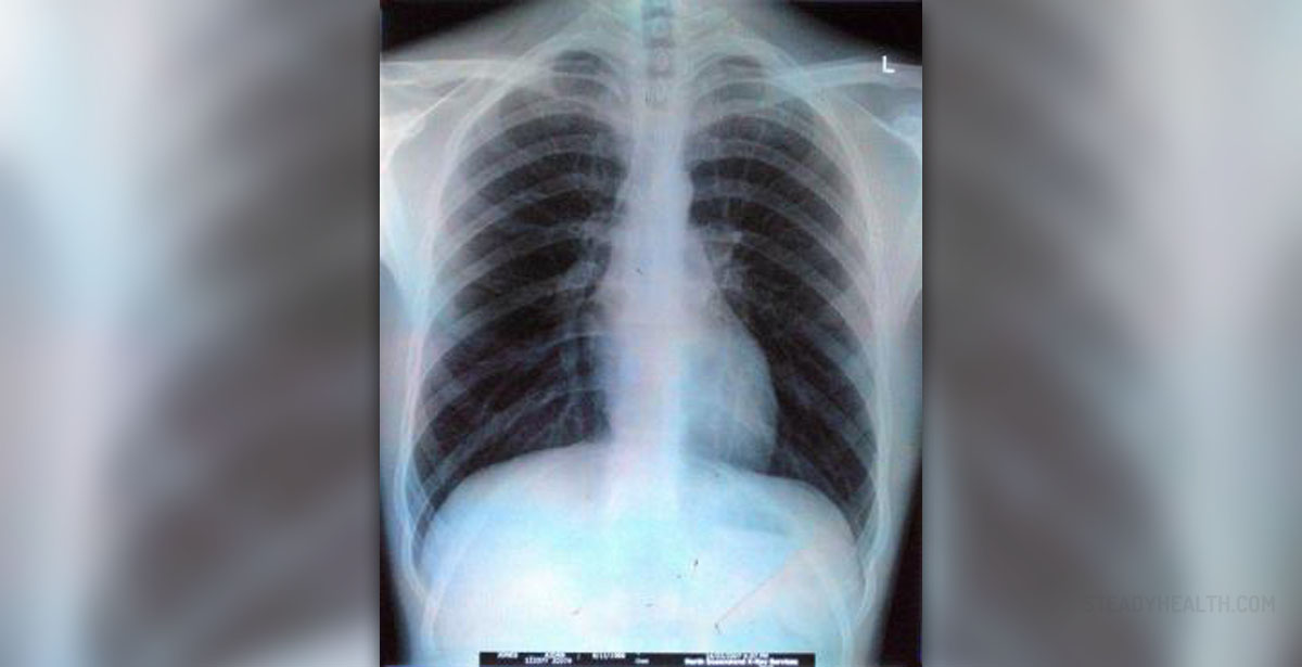 pain in centre of chest