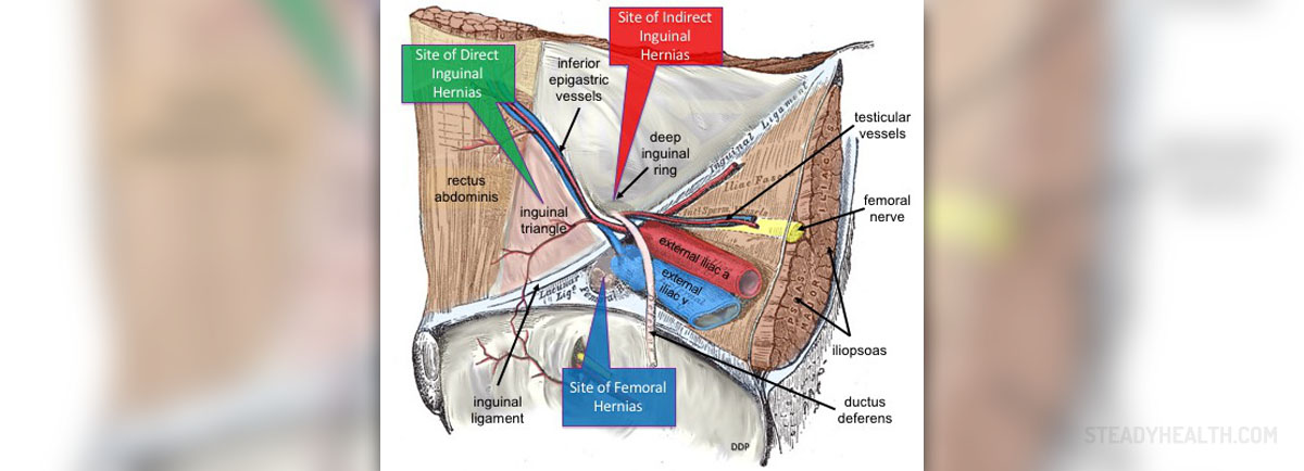 Pain in lower right abdomen | General center | SteadyHealth.com