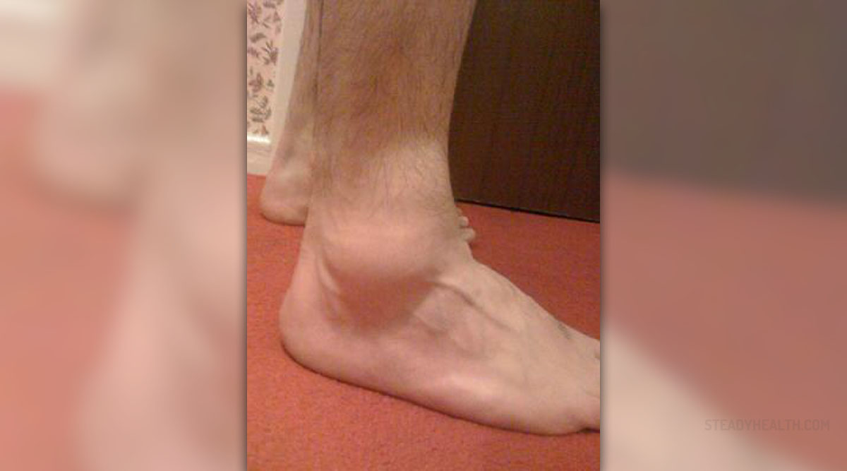 Pain in swollen ankle General center