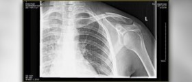 Pain under right shoulder blade