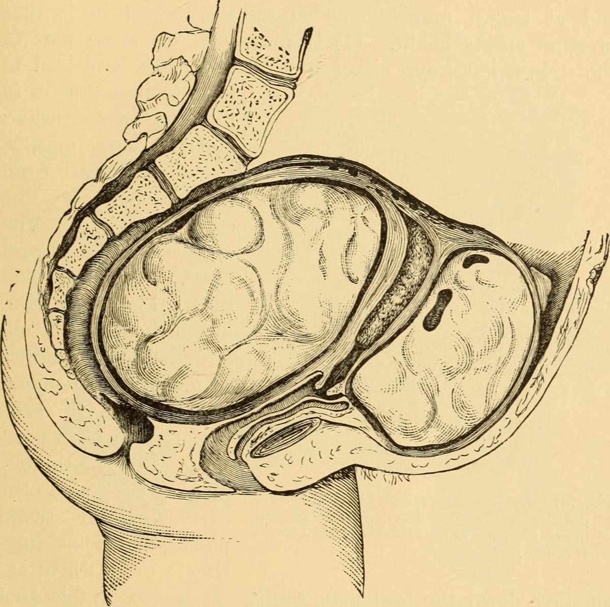 painful-fibroids-general-center-steadyhealth