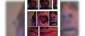 Painful GERD symptoms