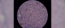 Painful liver causes