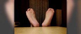 Painful sole of foot