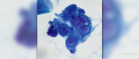 Pap smear procedure