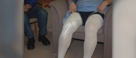 Partial knee replacement recovery