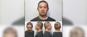 Patchy hair loss