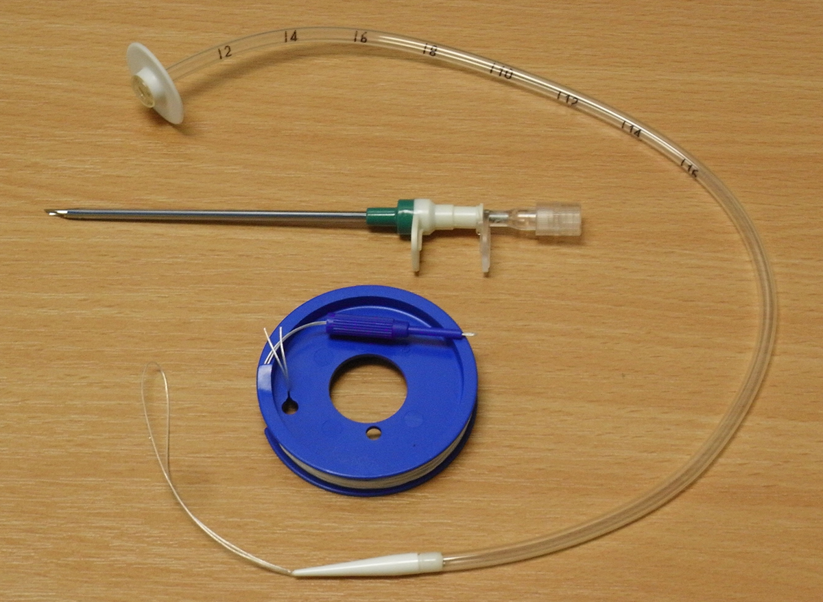 PEG Tube Placement Percutaneous Endoscopic Gastrostomy 