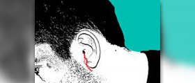 Perforated Eardrum symptoms